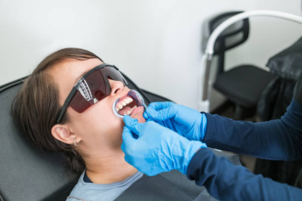 Best Teeth Whitening  in St Marys, OH